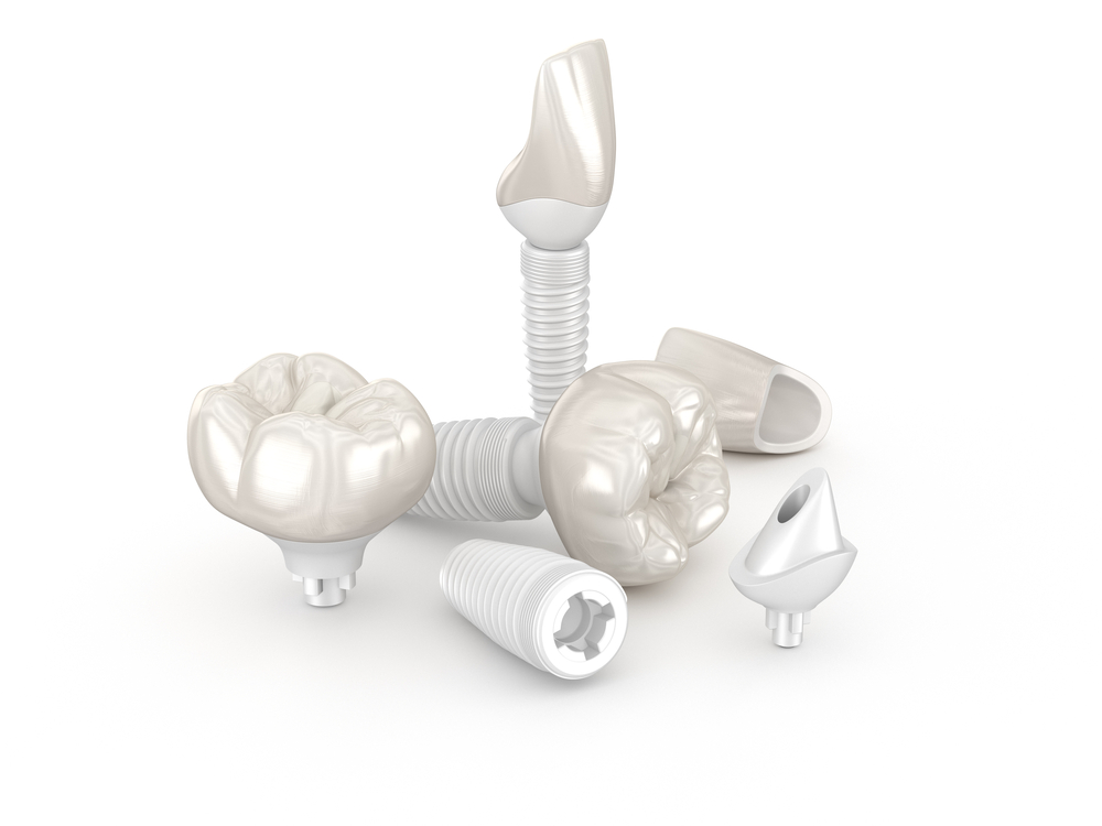 ceramic implants crowns
