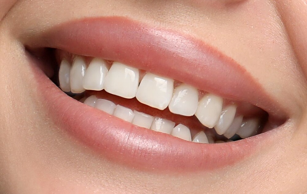 Dental